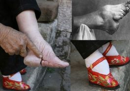 foot binding