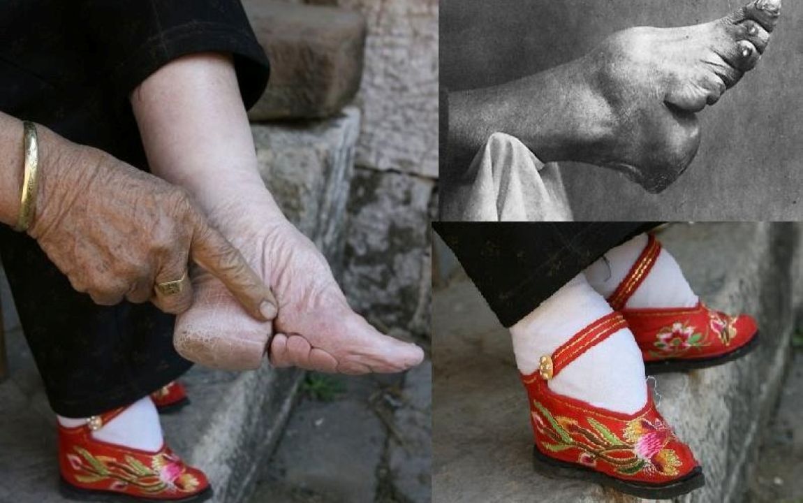 foot binding