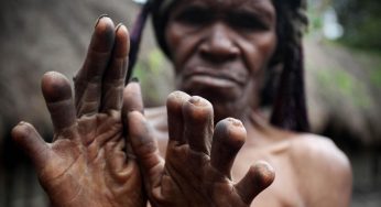 Finger Cutting Ritual: Tradisi Duka Memotong Jari di Papua Nugini